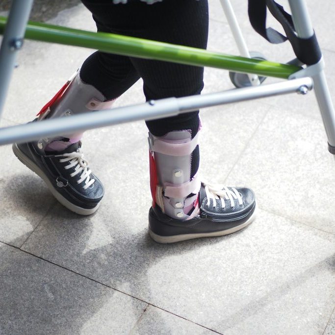child walking with braces child walking with braces